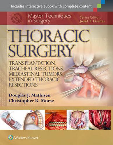 Cover image for Master Techniques in Surgery: Thoracic Surgery: Transplantation, Tracheal Resections, Mediastinal Tumors, Extended Thoracic Resections