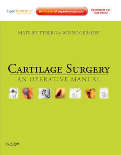 Cover image for Cartilage Surgery: An Operative Manual, Expert Consult: Online and Print