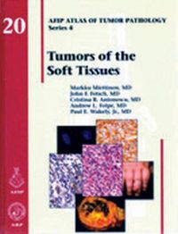 Cover image for Tumors of the Soft Tissues