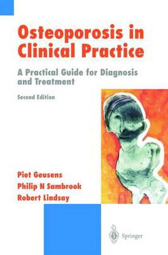 Cover image for Osteoporosis in Clinical Practice: A Practical Guide for Diagnosis and Treatment