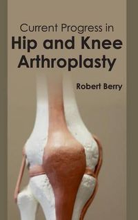 Cover image for Current Progress in Hip and Knee Arthroplasty