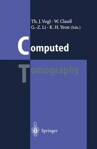 Cover image for Computed Tomography: State of the Art and Future Applications