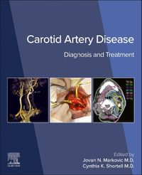 Cover image for Carotid Artery Disease