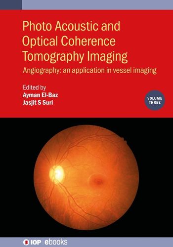 Cover image for Photo Acoustic and Optical Coherence Tomography Imaging, Volume 3: Angiography: an application in vessel imaging
