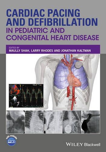 Cover image for Cardiac Pacing and Defibrillation in Pediatric and  Congenital Heart Disease