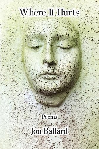 Cover image for Where It Hurts