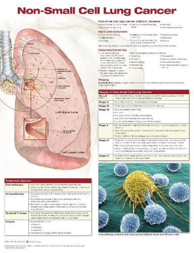 Cover image for Non-Small Cell Lung Cancer