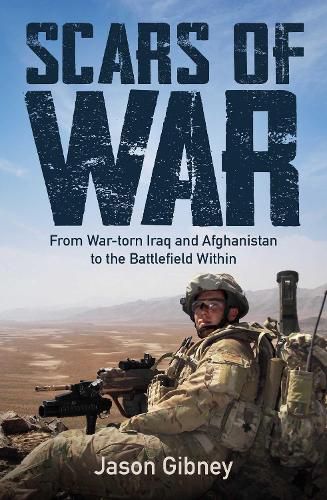 Cover image for Scars of War