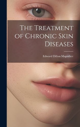 Cover image for The Treatment of Chronic Skin Diseases