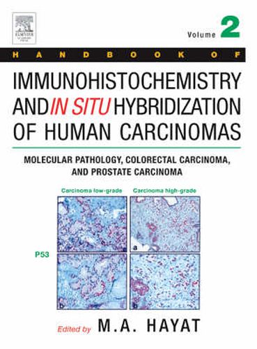 Cover image for Handbook of Immunohistochemistry and in Situ Hybridization of Human Carcinomas: Molecular Pathology, Colorectal Carcinoma, and Prostate Carcinoma