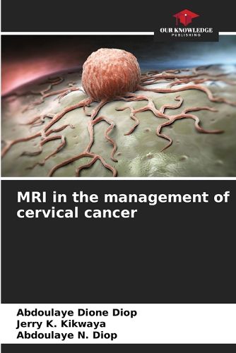 Cover image for MRI in the management of cervical cancer
