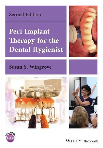 Cover image for Peri-Implant Therapy for the Dental Hygienist