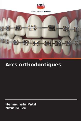 Cover image for Arcs orthodontiques