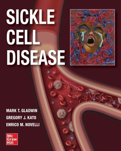 Cover image for Sickle Cell Disease