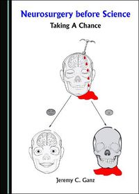 Cover image for Neurosurgery before Science: Taking a Chance