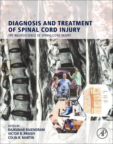 Cover image for Diagnosis and Treatment of Spinal Cord Injury