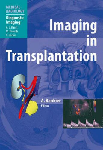 Cover image for Imaging in Transplantation