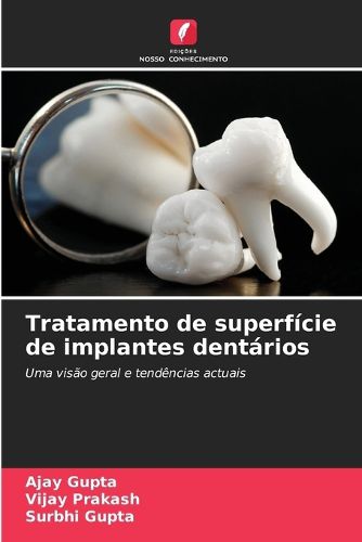 Cover image for Tratamento de superficie de implantes dentarios