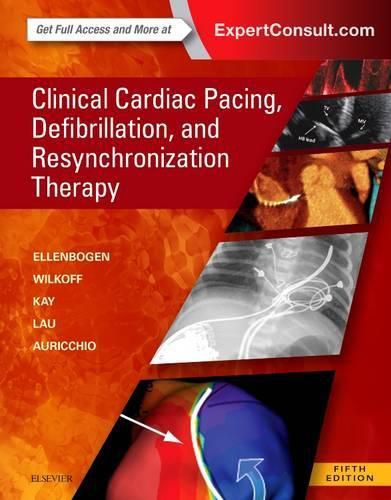 Cover image for Clinical Cardiac Pacing, Defibrillation and Resynchronization Therapy