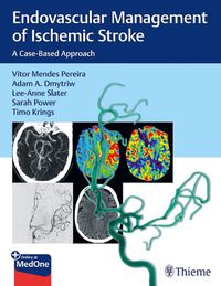 Cover image for Endovascular Management of Ischemic Stroke: A Case-Based Approach