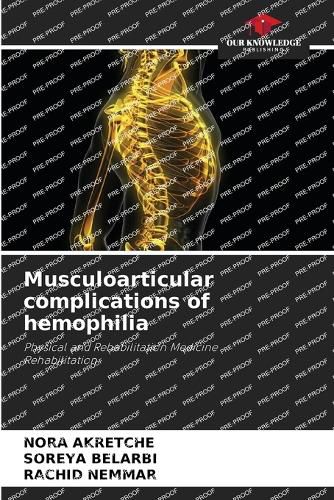 Cover image for Musculoarticular complications of hemophilia