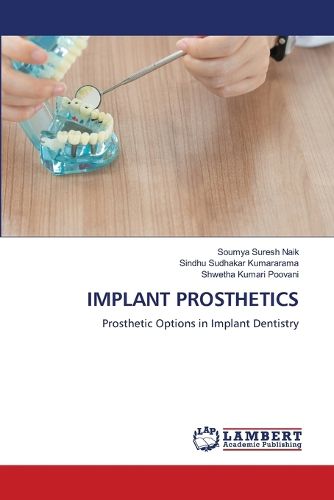 Cover image for Implant Prosthetics