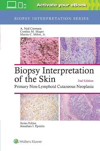 Cover image for Biopsy Interpretation of the Skin: Primary Non-Lymphoid Cutaneous Neoplasia