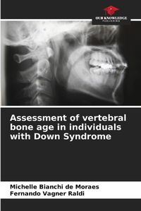 Cover image for Assessment of vertebral bone age in individuals with Down Syndrome