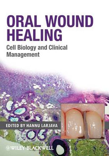 Cover image for Oral Wound Healing: Cell Biology and Clinical Management