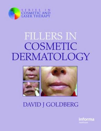 Cover image for Fillers in Cosmetic Dermatology