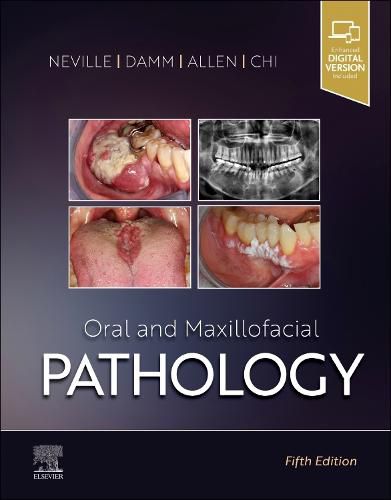 Cover image for Oral and Maxillofacial Pathology