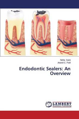 Cover image for Endodontic Sealers: An Overview