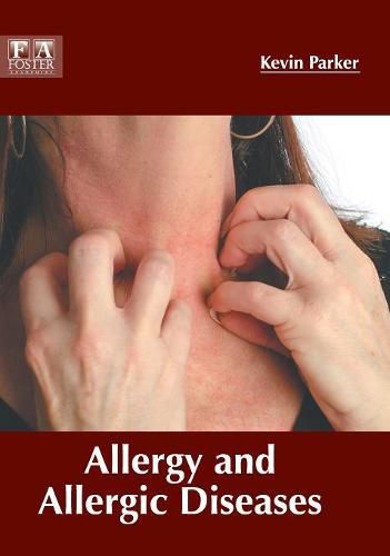 Cover image for Allergy and Allergic Diseases