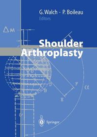 Cover image for Shoulder Arthroplasty