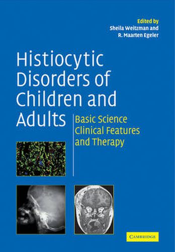 Cover image for Histiocytic Disorders of Children and Adults: Basic Science, Clinical Features and Therapy