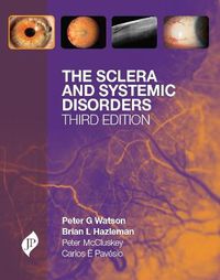 Cover image for The Sclera and Systemic Disorders