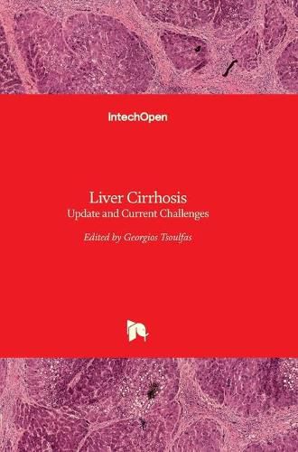 Cover image for Liver Cirrhosis: Update and Current Challenges