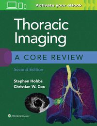 Cover image for Thoracic Imaging: A Core Review