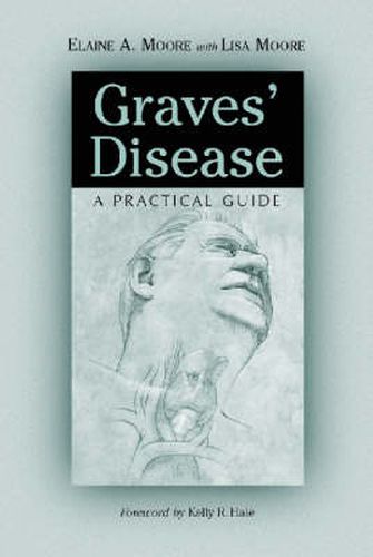 Graves' Disease: A Practical Guide