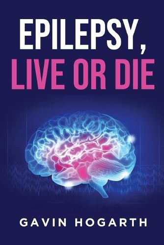 Cover image for Epilepsy: Live or Die