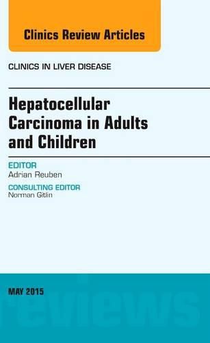 Cover image for Hepatocellular Carcinoma in Adults and Children, An Issue of Clinics in Liver Disease