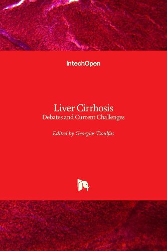 Cover image for Liver Cirrhosis: Debates and Current Challenges