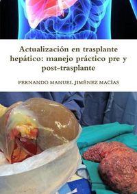 Cover image for Actualizacion en trasplante hepatico