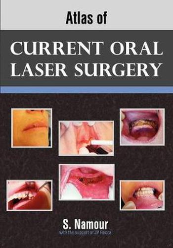 Cover image for Atlas of Current Oral Laser Surgery