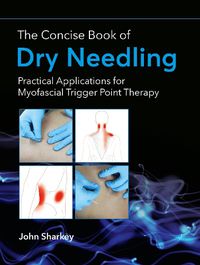 Cover image for The Concise Book of Dry Needling: A Practitioner's Guide to Myofascial Trigger Point Applications