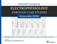 Cover image for Essential Concepts of Electrophysiology Through Case Studies: Intracardiac EGMs: Intracardiac EGMs