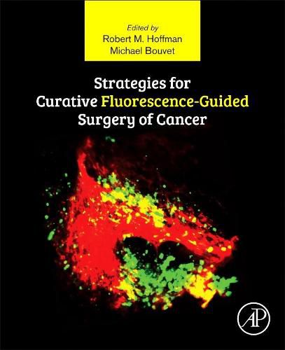 Cover image for Strategies for Curative Fluorescence-Guided Surgery of Cancer