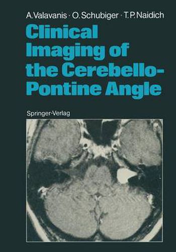 Cover image for Clinical Imaging of the Cerebello-Pontine Angle