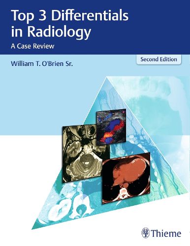 Cover image for Top 3 Differentials in Radiology: A Case Review