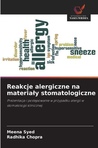 Cover image for Reakcje alergiczne na materialy stomatologiczne